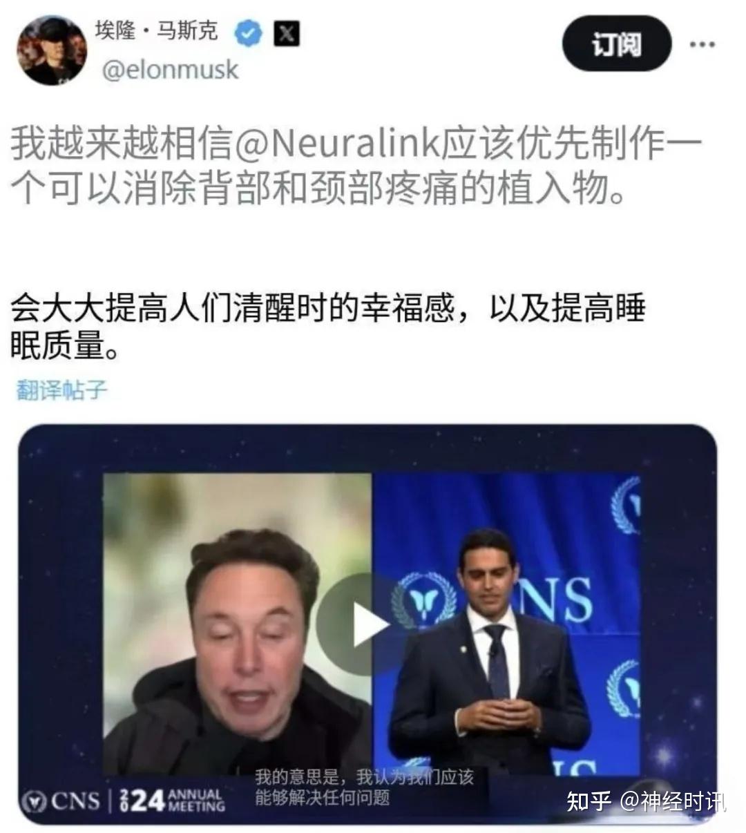 多路线齐头并进 脑机接口产业化进程加速