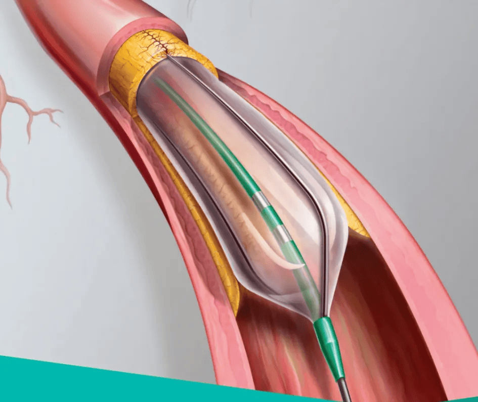 博济医药：九泰药械提供脑神经医疗器械临床研究服务