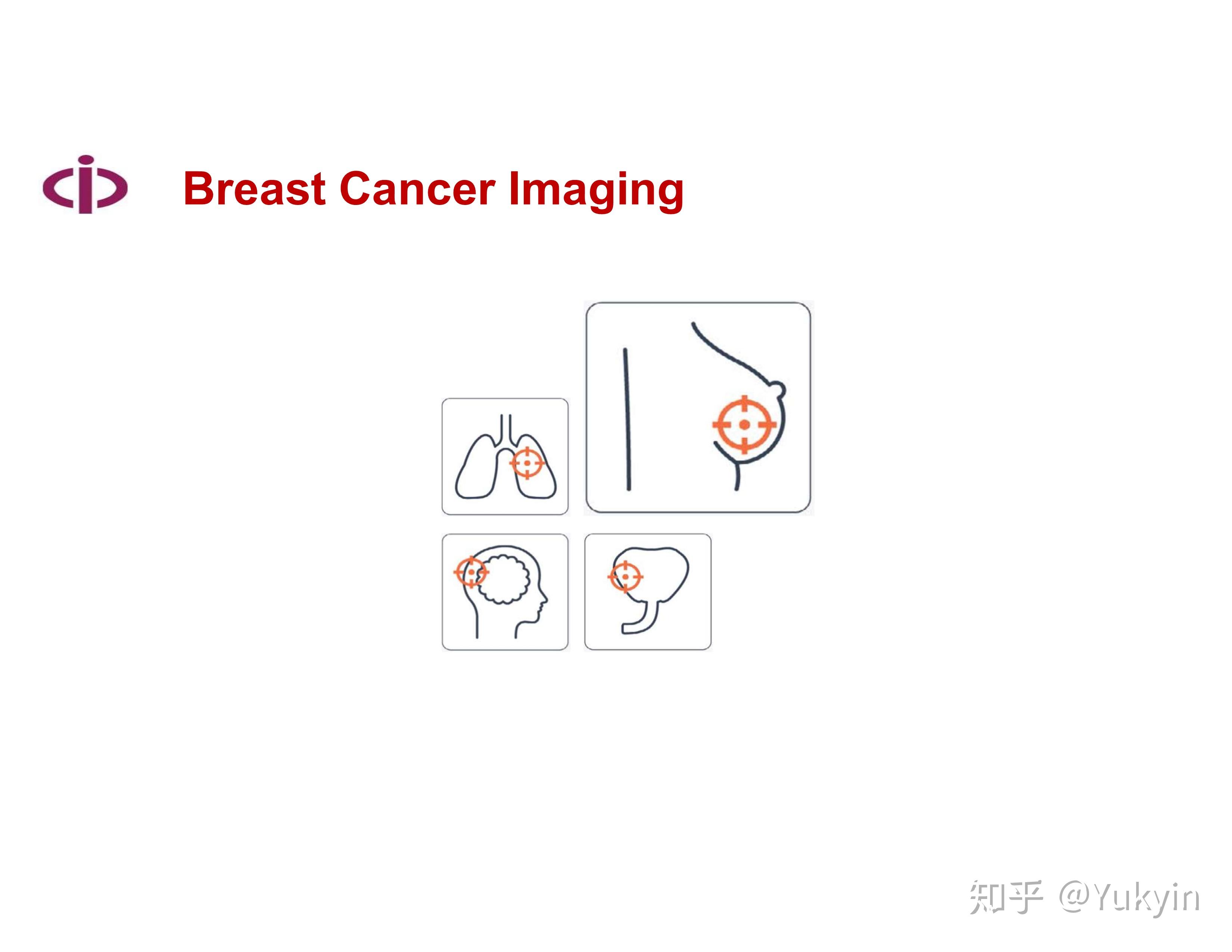 俄研究机构训练人工智能识别早期乳腺癌